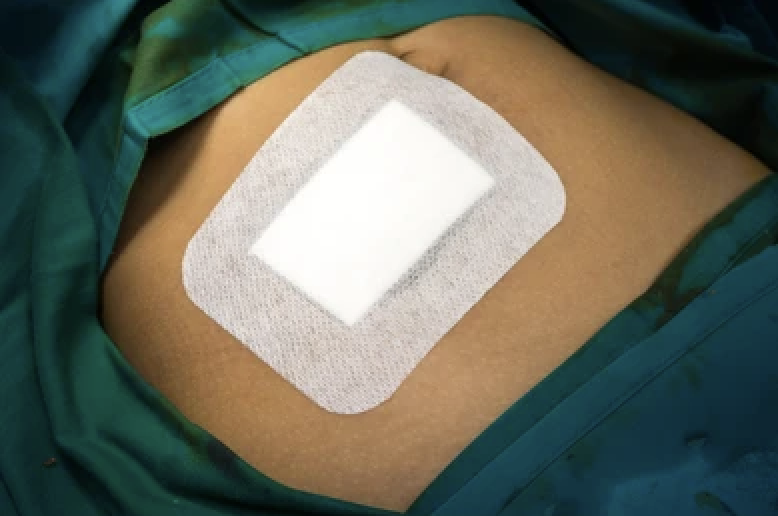 Bild till artikeln: HBOT: Effektiv inom Plastisk & Rekonstruktiv Kirurgi